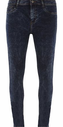 Dorothy Perkins Womens Acid Wash Fly Front Jeggings- Blue